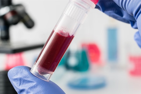 Drug Screening and Confirmation