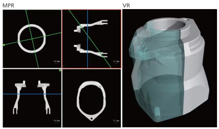 Multi Planar Reconstruction (MPR) Display and Volume Rendering (VR) Display
